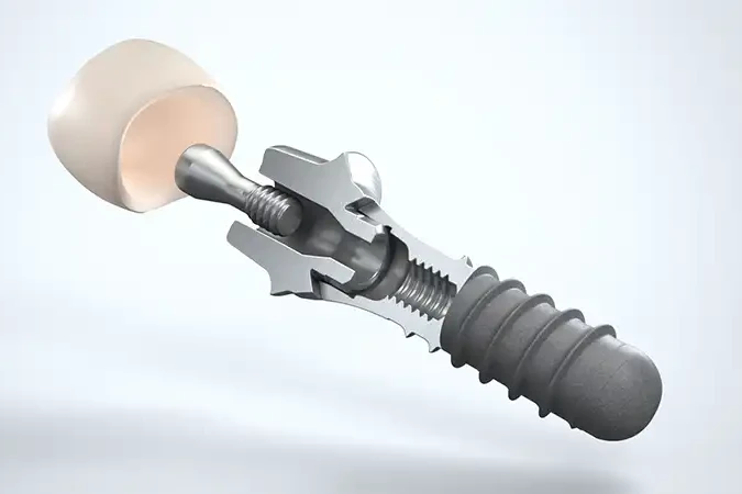 3d-produktvisualisierung-zahnimplantat-explosionsdarstellung